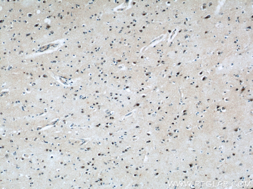 Immunohistochemistry (IHC) staining of human brain tissue using ZNF597 Polyclonal antibody (20922-1-AP)