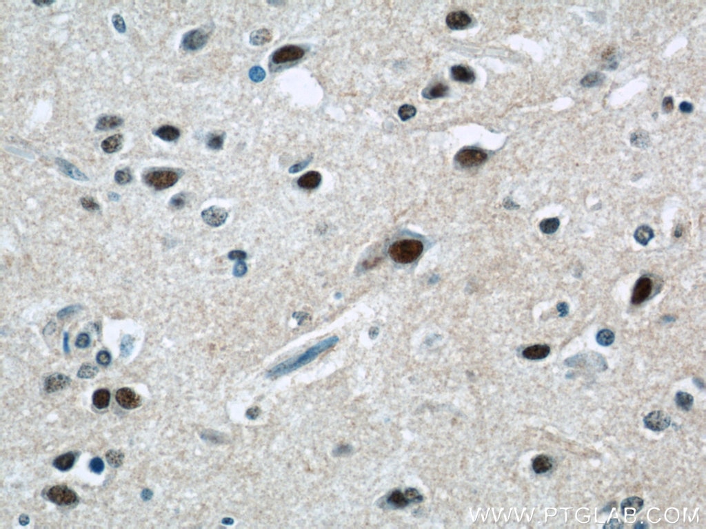 Immunohistochemistry (IHC) staining of human brain tissue using ZNF597 Polyclonal antibody (20922-1-AP)