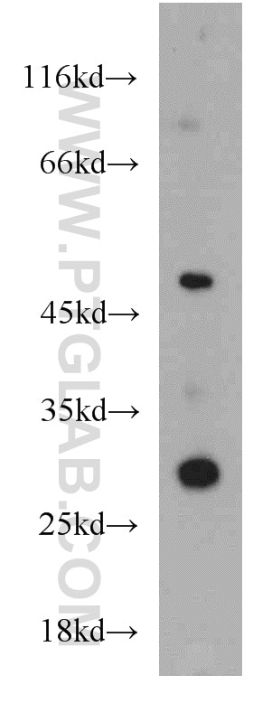 Western Blot (WB) analysis of Jurkat cells using ZNF597 Polyclonal antibody (20922-1-AP)