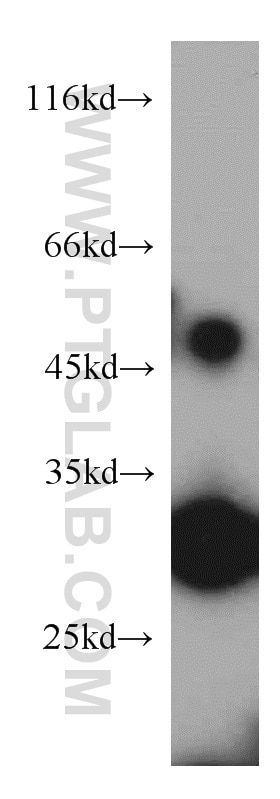 Western Blot (WB) analysis of HeLa cells using ZNF597 Polyclonal antibody (20922-1-AP)