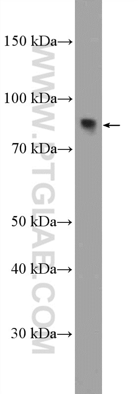 Western Blot (WB) analysis of mouse kidney tissue using ZNF600-Specific Polyclonal antibody (20100-1-AP)