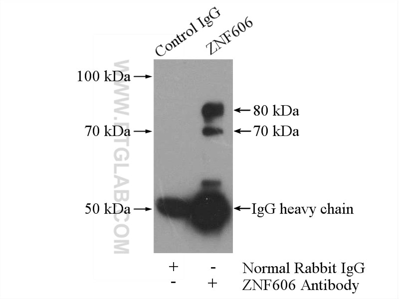 Immunoprecipitation (IP) experiment of mouse liver tissue using ZNF606 Polyclonal antibody (26128-1-AP)