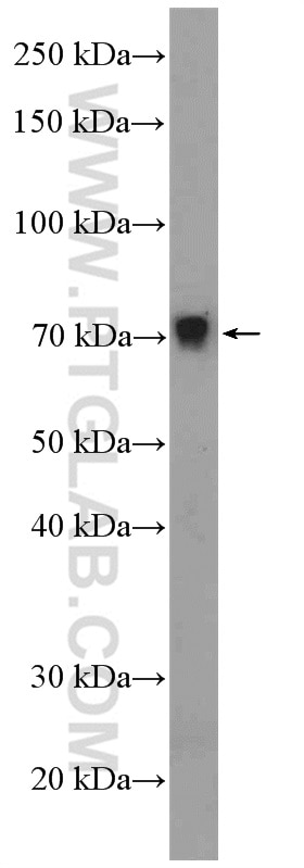 Western Blot (WB) analysis of mouse liver tissue using ZNF606 Polyclonal antibody (26128-1-AP)