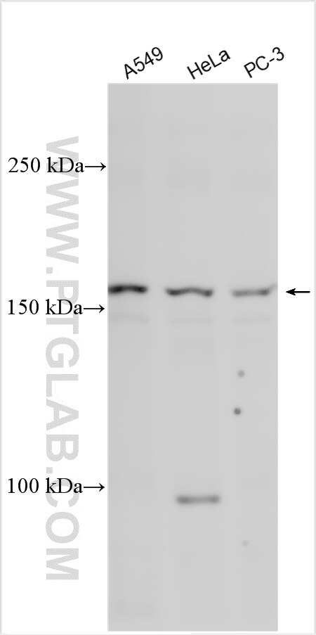 Western Blot (WB) analysis of various lysates using ZNF608-Specific Polyclonal antibody (20063-1-AP)
