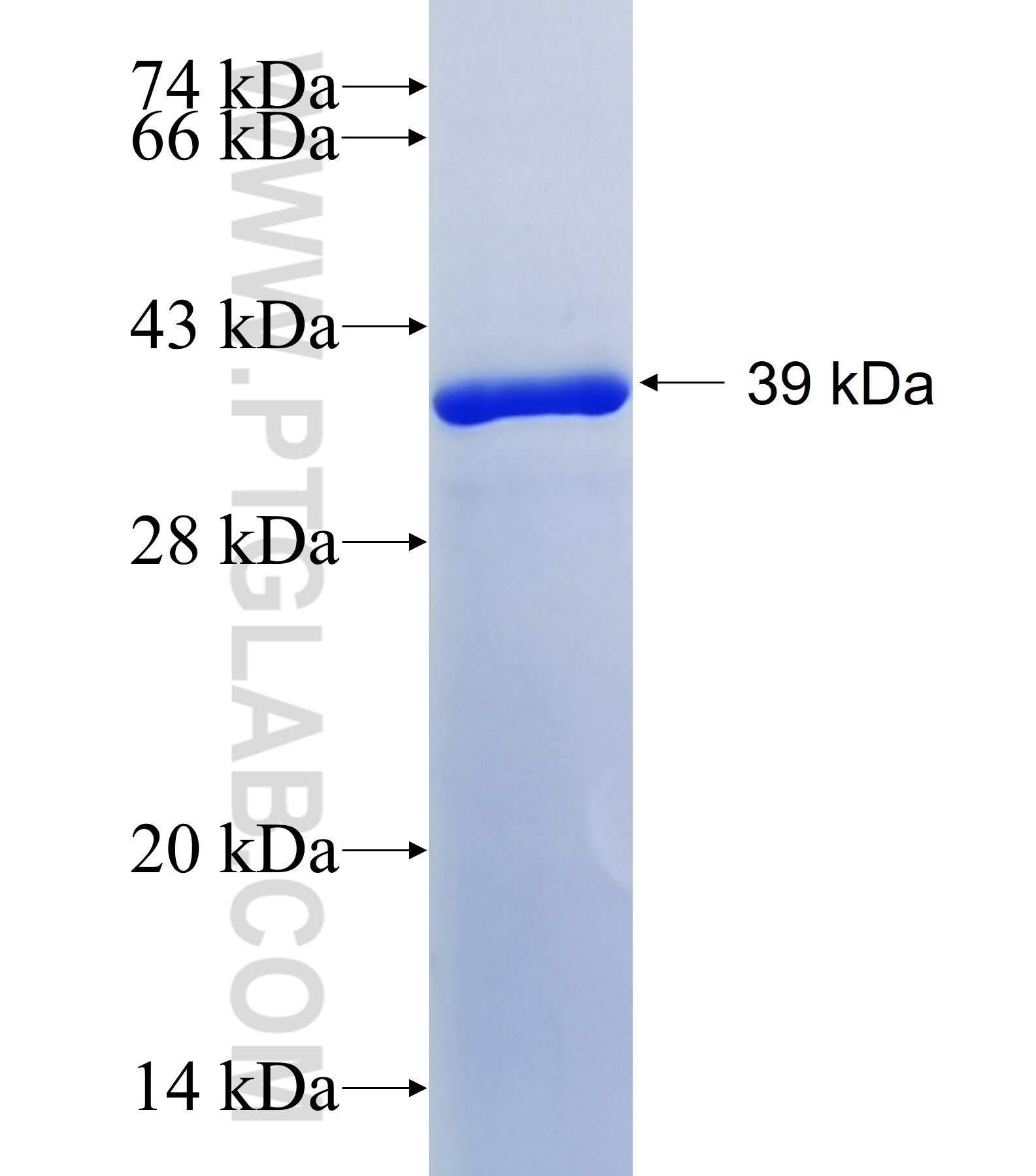 ZNF609 fusion protein Ag41374 SDS-PAGE ZNF609 fusion protein Ag41374 SDS-PAGE