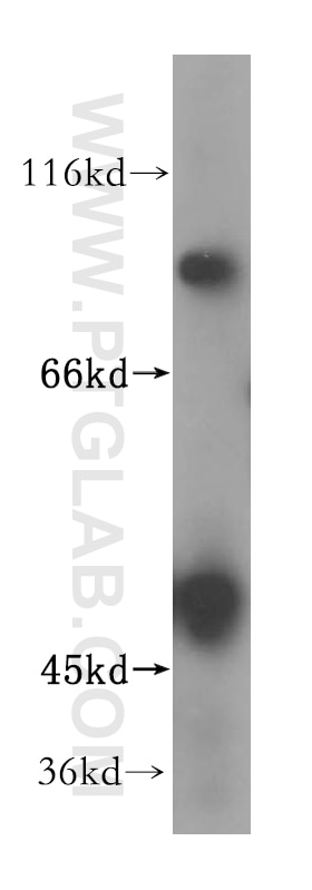 Western Blot (WB) analysis of HEK-293 cells using ZNF611 Polyclonal antibody (17249-1-AP)