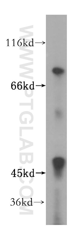 Western Blot (WB) analysis of mouse brain tissue using ZNF611 Polyclonal antibody (17249-1-AP)