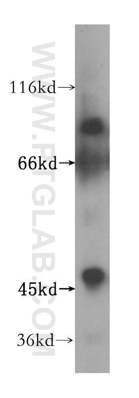 Western Blot (WB) analysis of Jurkat cells using ZNF611 Polyclonal antibody (17249-1-AP)