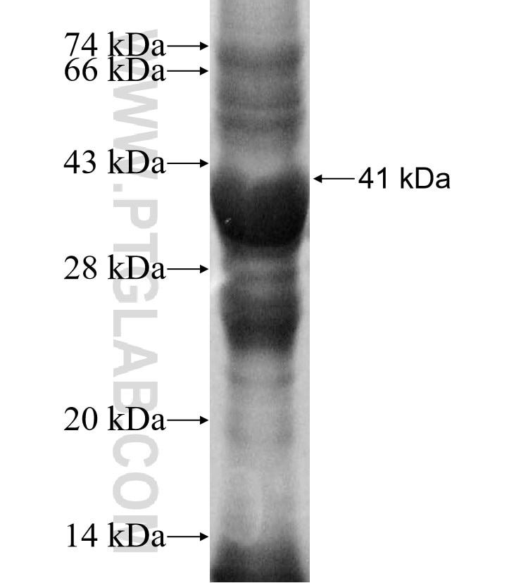 ZNF611 fusion protein Ag9984 SDS-PAGE