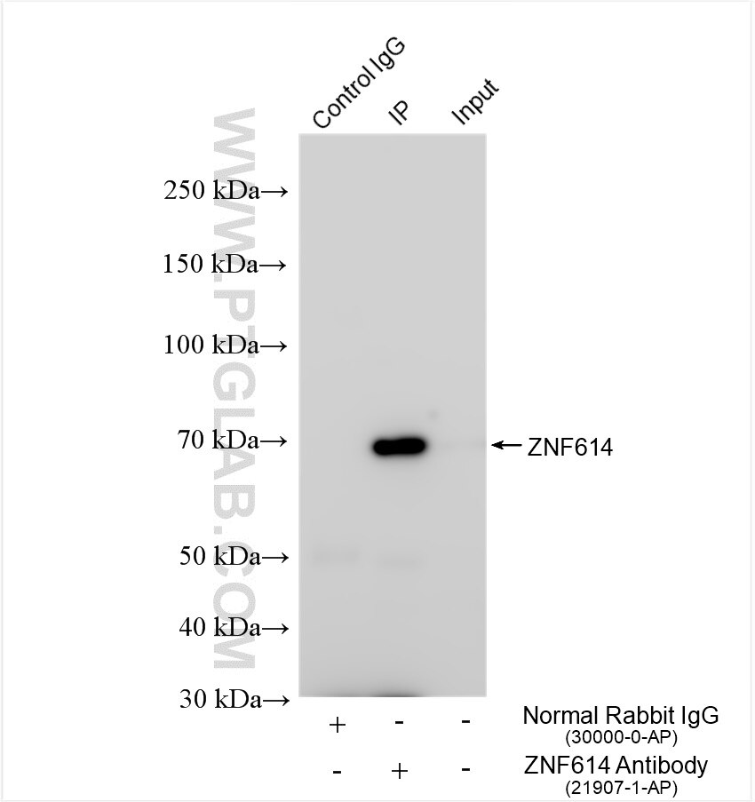 ZNF614
