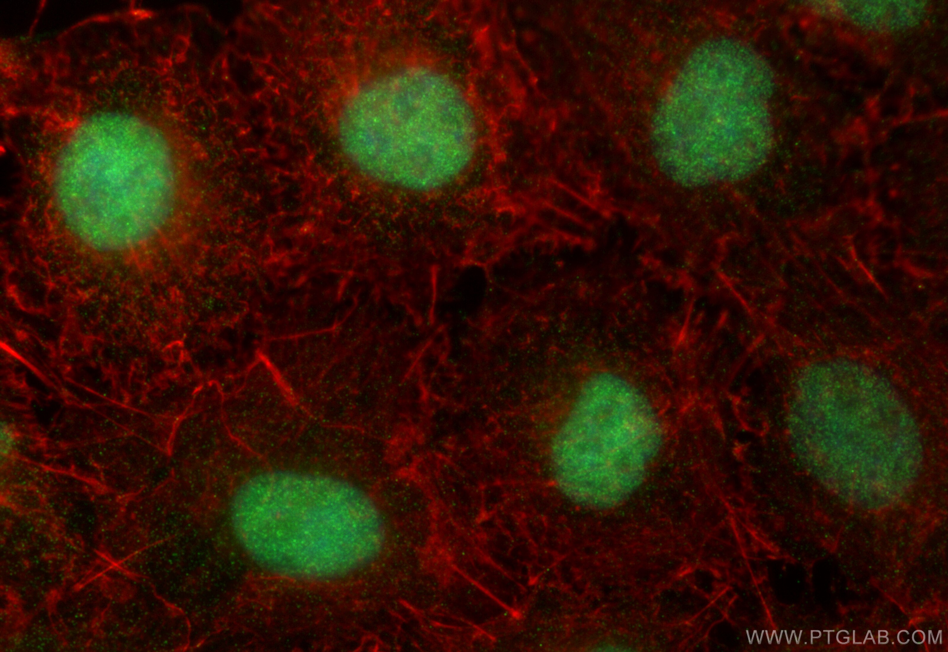Immunofluorescence (IF) / fluorescent staining of A549 cells using ZNF618 Polyclonal antibody (31972-1-AP)