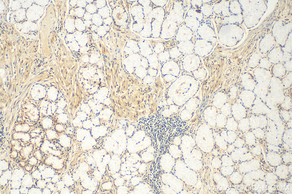 ZNF618