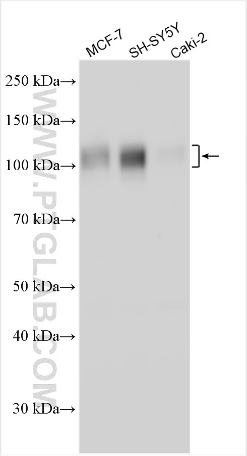 Western Blot (WB) analysis of various lysates using ZNF618 Polyclonal antibody (31972-1-AP)