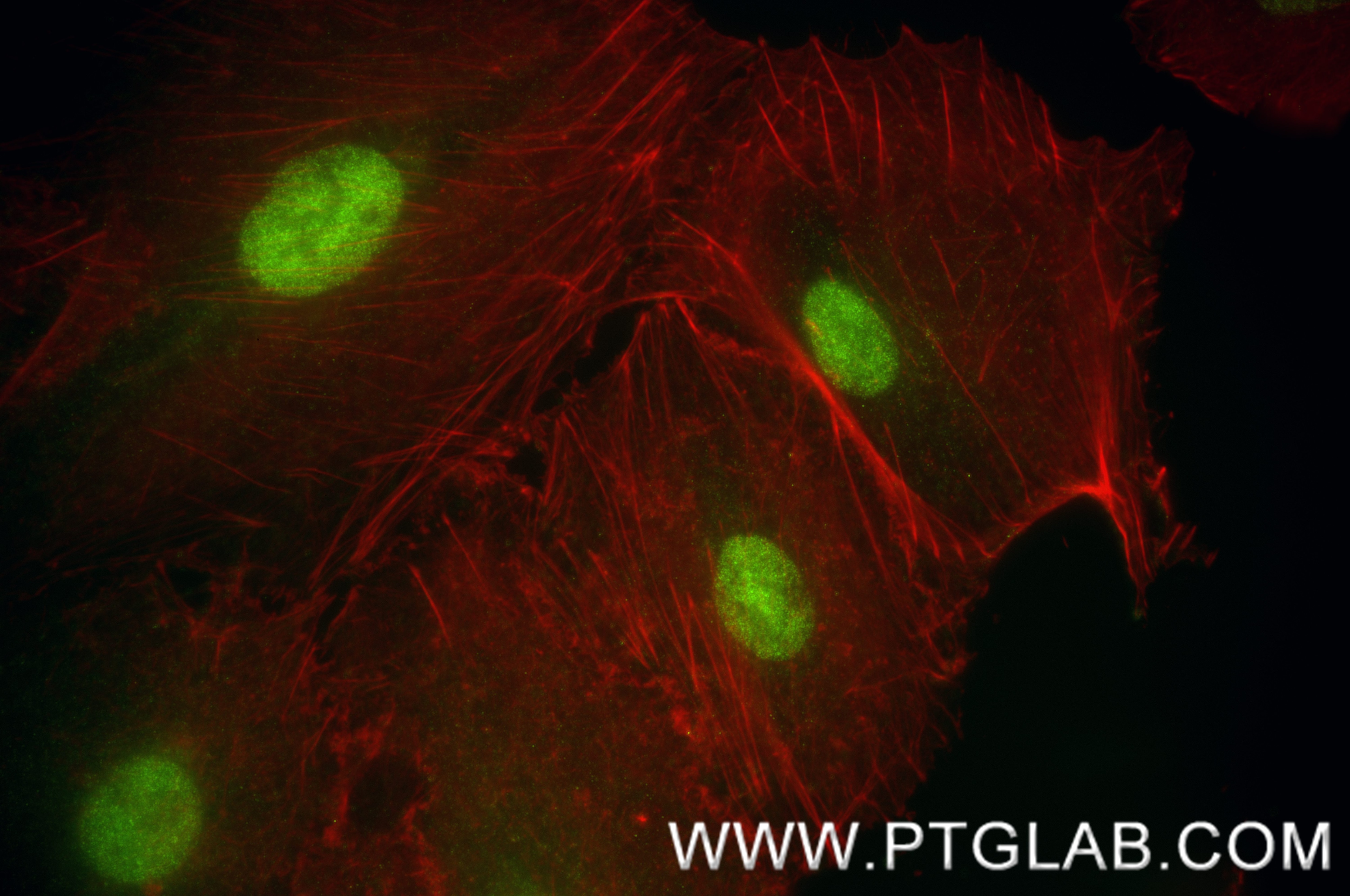 Immunofluorescence (IF) / fluorescent staining of A549 cells using ZNF618 Recombinant antibody (84998-1-RR)
