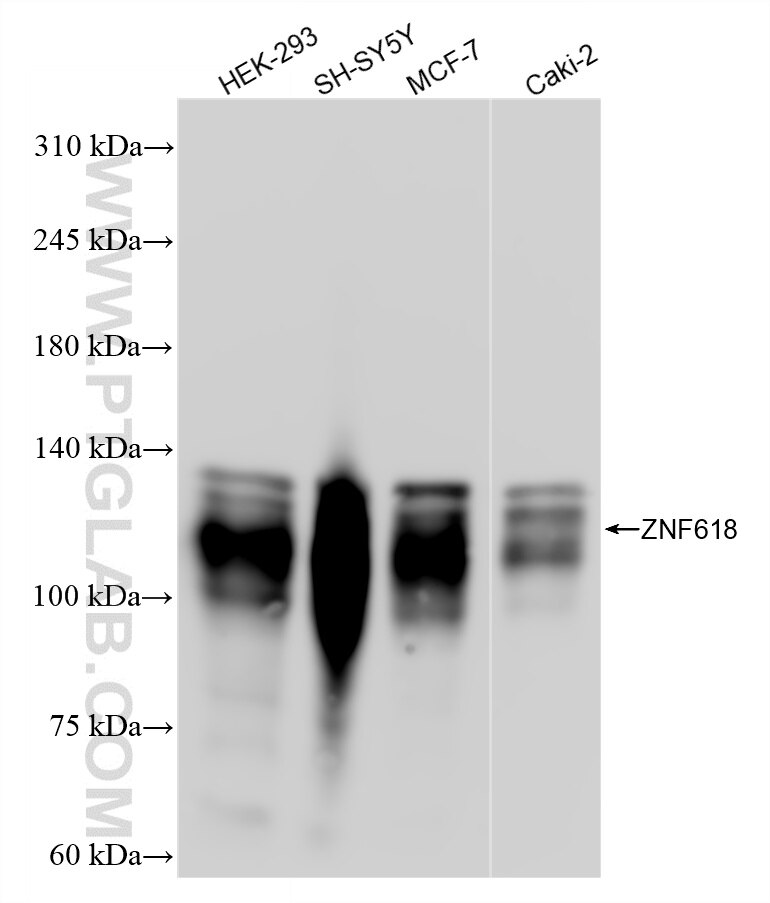Western Blot (WB) analysis of various lysates using ZNF618 Recombinant antibody (84998-1-RR)