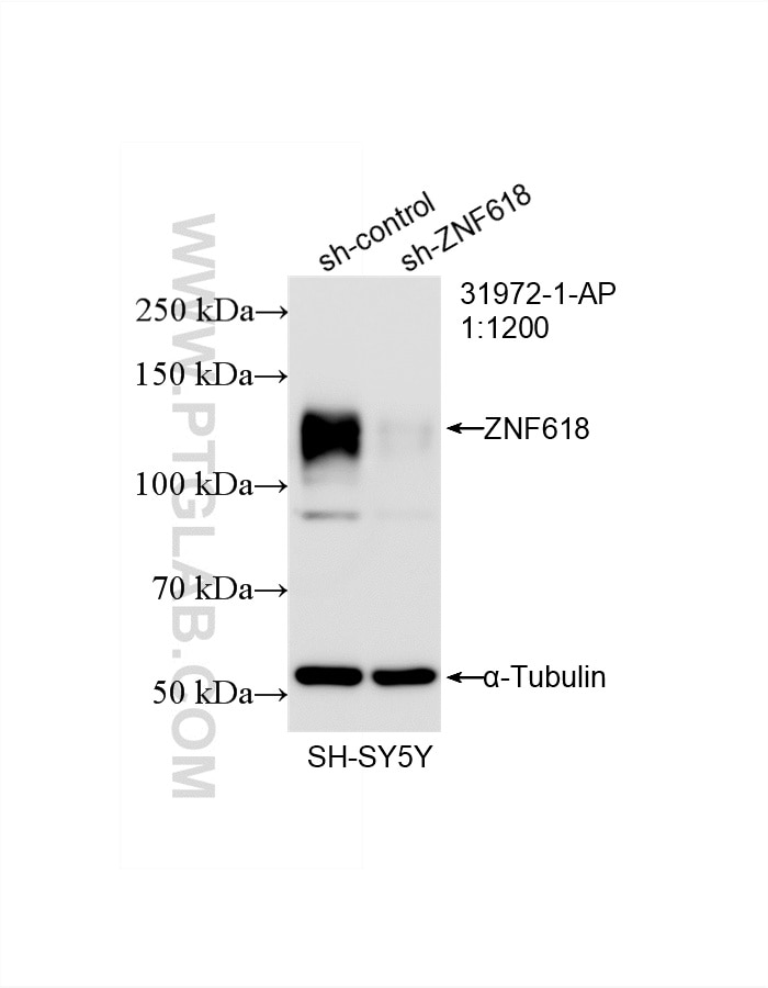 Western Blot (WB) analysis of SH-SY5Y cells using ZNF618 Recombinant monoclonal antibody (84998-1-RR)