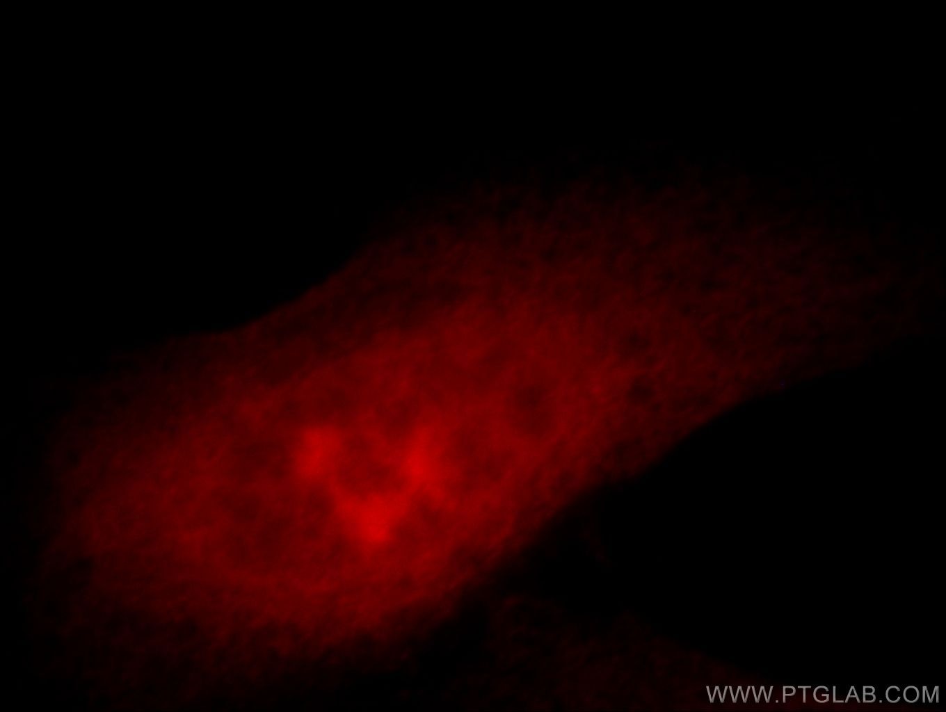 Immunofluorescence (IF) / fluorescent staining of HeLa cells using ZNF622 Polyclonal antibody (20804-1-AP)