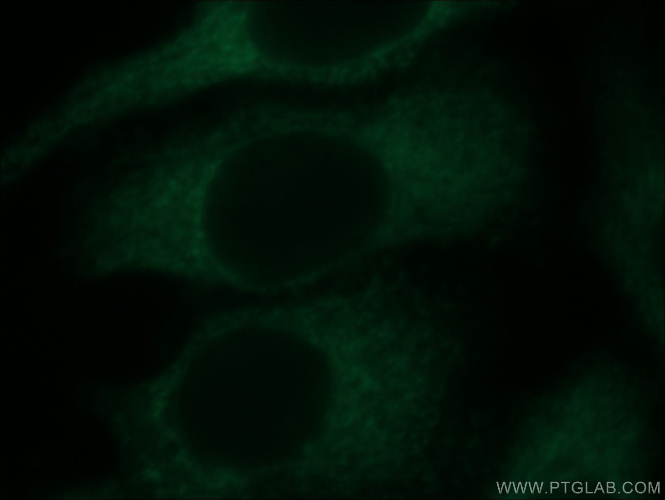Immunofluorescence (IF) / fluorescent staining of HepG2 cells using ZNF622 Polyclonal antibody (20804-1-AP)