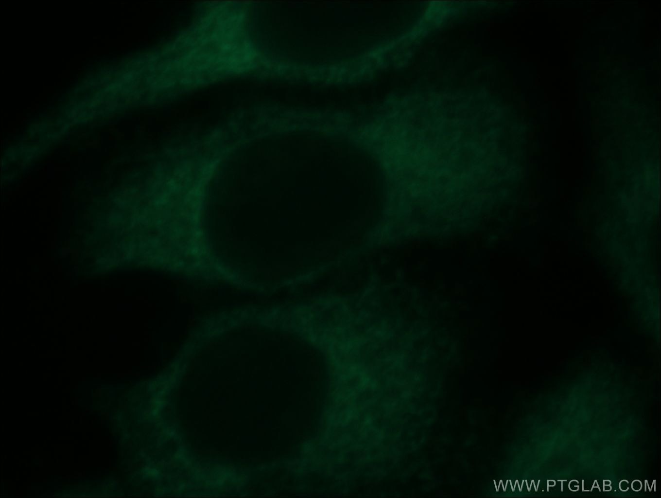 IF Staining of HepG2 using 20804-1-AP