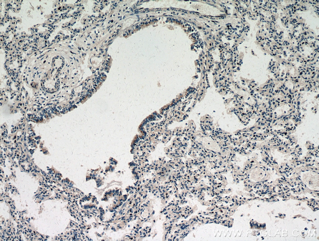 Immunohistochemistry (IHC) staining of human lung tissue using ZNF622 Polyclonal antibody (20804-1-AP)