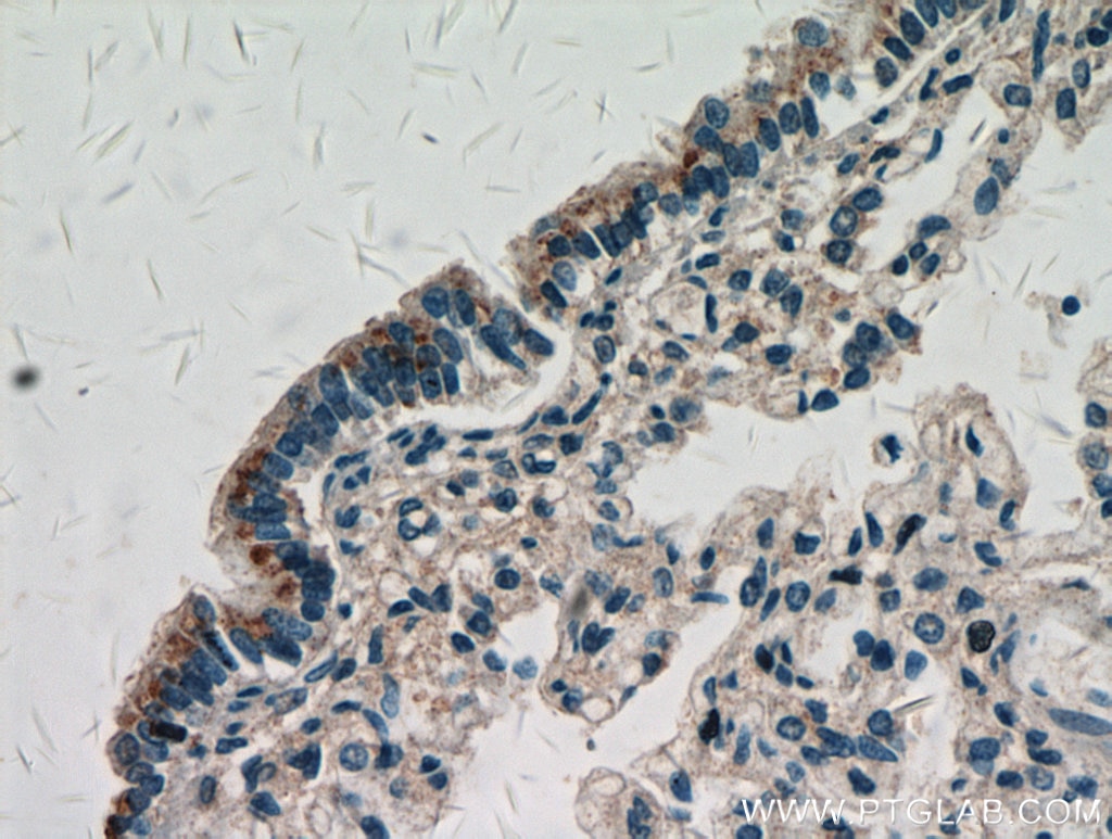 Immunohistochemistry (IHC) staining of human lung tissue using ZNF622 Polyclonal antibody (20804-1-AP)