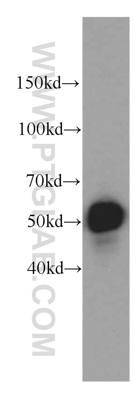 Western Blot (WB) analysis of HeLa cells using ZNF622 Polyclonal antibody (20804-1-AP)