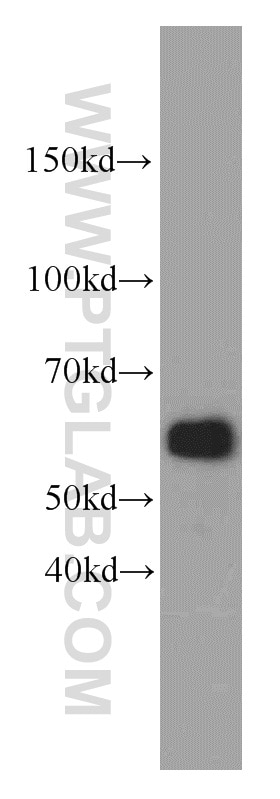 Western Blot (WB) analysis of HEK-293 cells using ZNF622 Polyclonal antibody (20804-1-AP)