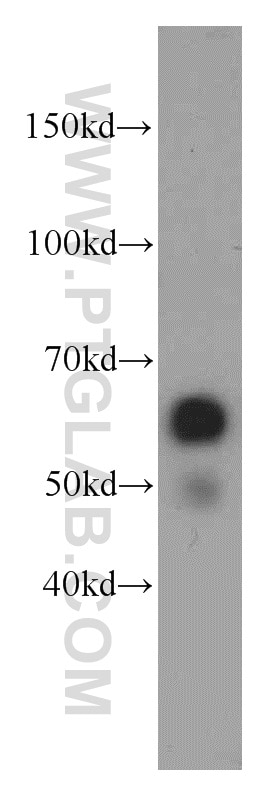 Western Blot (WB) analysis of human brain tissue using ZNF622 Polyclonal antibody (20804-1-AP)