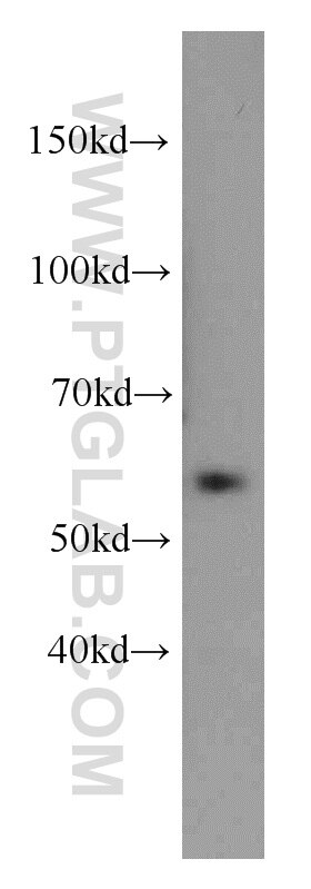 Western Blot (WB) analysis of mouse lung tissue using ZNF622 Polyclonal antibody (20804-1-AP)
