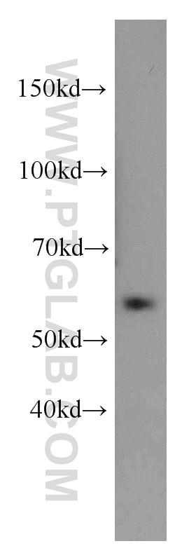 Western Blot (WB) analysis of mouse lung tissue using ZNF622 Polyclonal antibody (20804-1-AP)