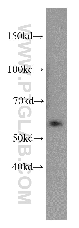 Western Blot (WB) analysis of mouse lung tissue using ZNF622 Polyclonal antibody (20804-1-AP)