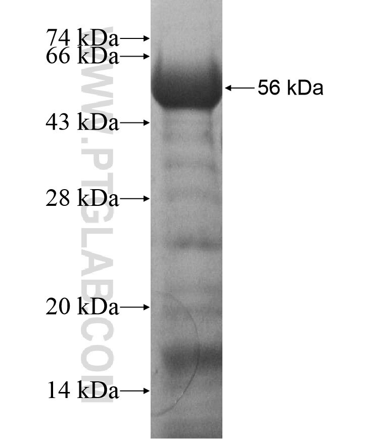 ZNF622 fusion protein Ag16973 SDS-PAGE