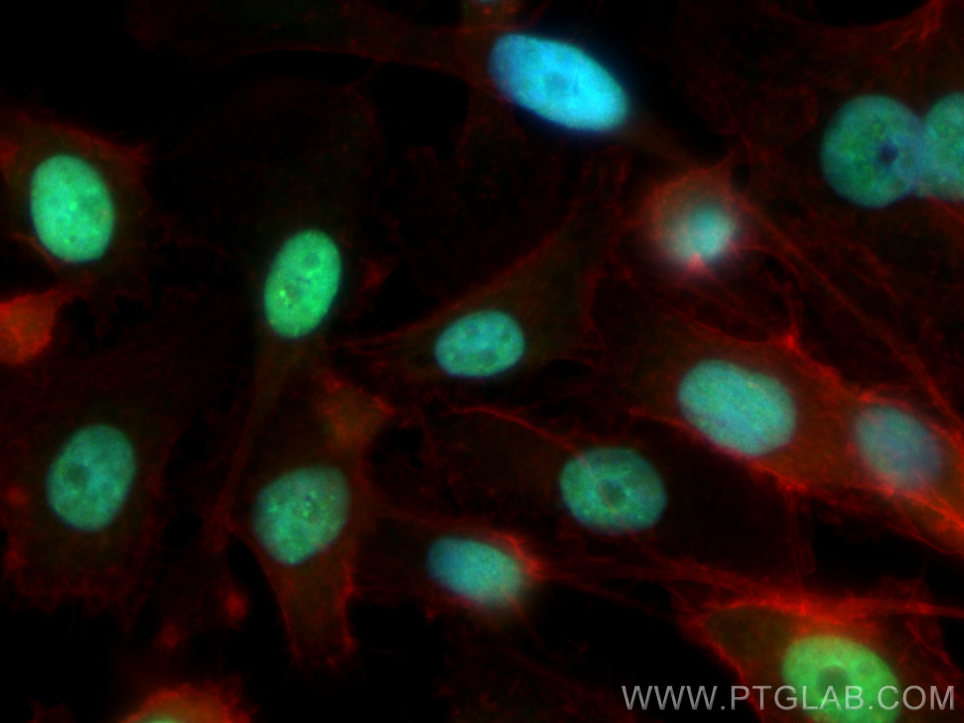 Immunofluorescence (IF) / fluorescent staining of PC-3 cells using ZNF625 Polyclonal antibody (21458-1-AP)