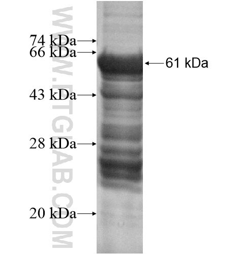 ZNF625 fusion protein Ag14758 SDS-PAGE