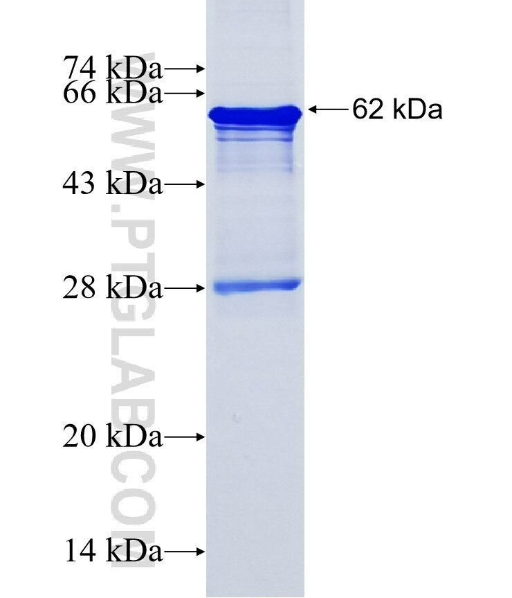 ZNF627 fusion protein Ag15048 SDS-PAGE