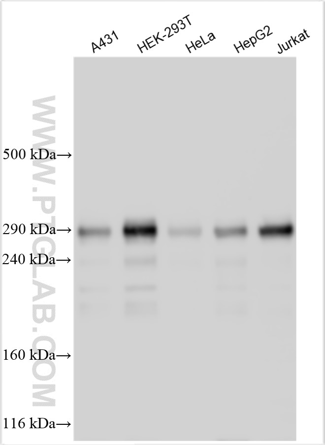 ZNF638