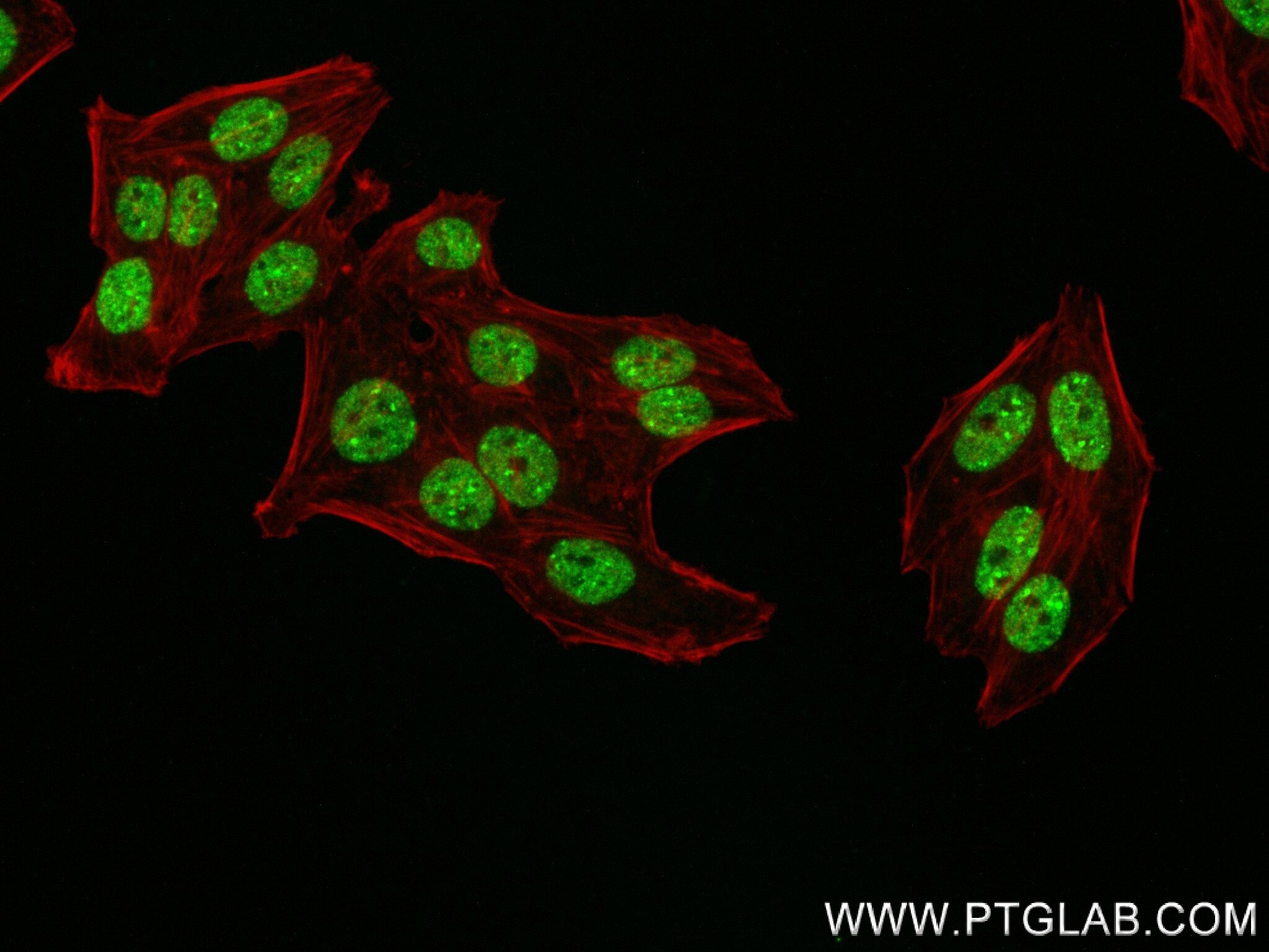 Immunofluorescence (IF) / fluorescent staining of HepG2 cells using ZNF638 Recombinant antibody (84359-3-RR)