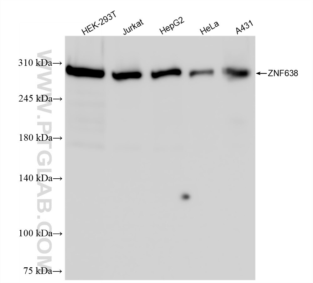 Western Blot (WB) analysis of various lysates using ZNF638 Recombinant antibody (84359-3-RR)