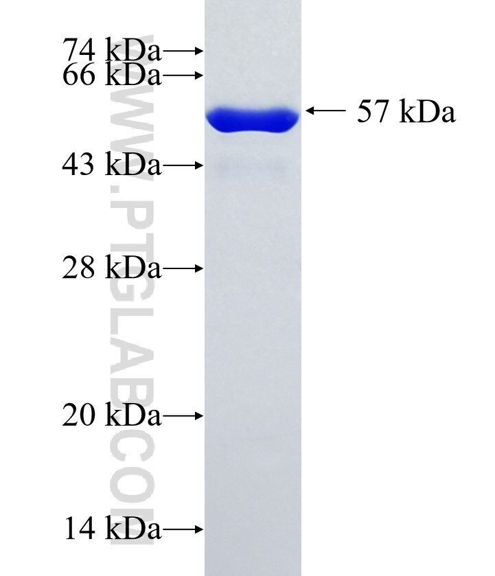 ZNF638 fusion protein Ag35296 SDS-PAGE