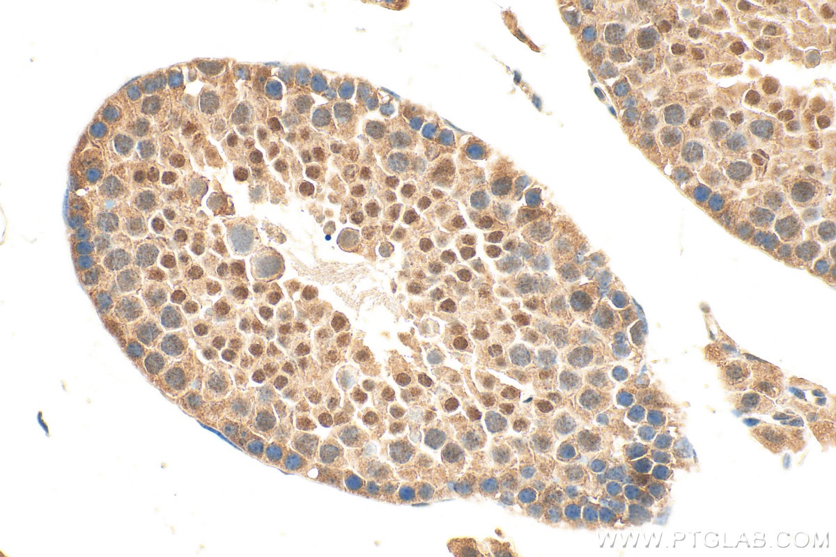 Immunohistochemical analysis of paraffin-embedded mouse testis tissue slide using 25817-1-AP (ZNF639 antibody) at dilution of 1:1000 (under 40x lens). Heat mediated antigen retrieval with Tris-EDTA buffer (pH 9.0). Immunohistochemistry (IHC) staining of mouse testis tissue using ZNF639 Polyclonal antibody (25817-1-AP)