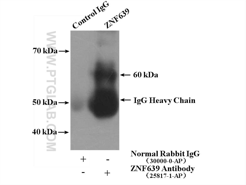 Immunoprecipitation (IP) experiment of HeLa cells using ZNF639 Polyclonal antibody (25817-1-AP)