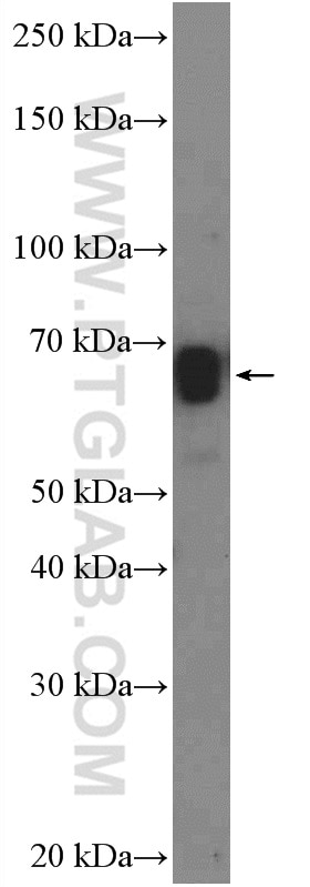 Western Blot (WB) analysis of HeLa cells using ZNF639 Polyclonal antibody (25817-1-AP)