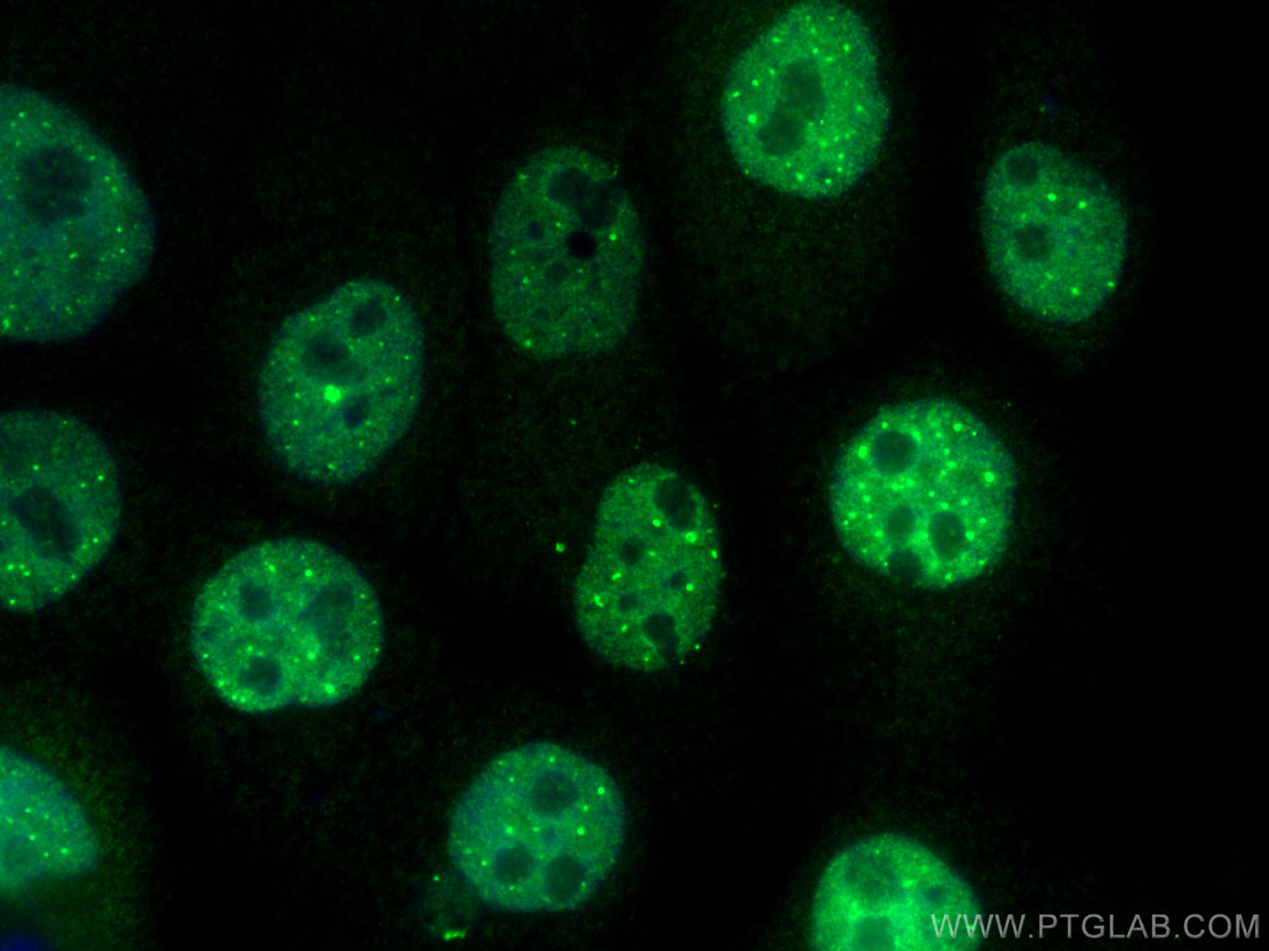 Immunofluorescence (IF) / fluorescent staining of A431 cells using ZNF641 Polyclonal antibody (26302-1-AP)