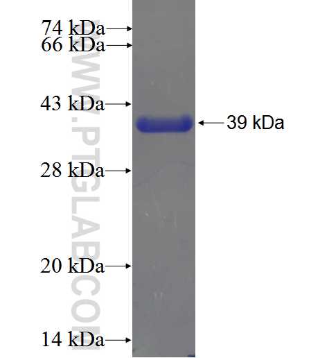 ZNF641 fusion protein Ag23672 SDS-PAGE