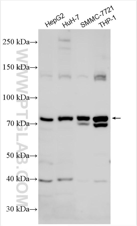 Western Blot (WB) analysis of various lysates using ZNF643 Polyclonal antibody (30018-1-AP)