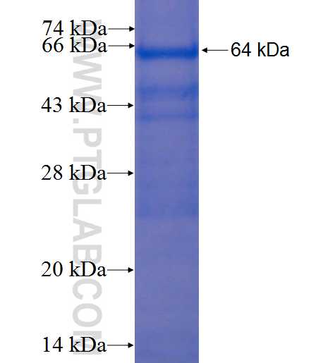 ZNF644 fusion protein Ag22798 SDS-PAGE