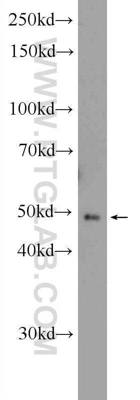 Western Blot (WB) analysis of human testis tissue using ZNF645 Polyclonal antibody (25600-1-AP)