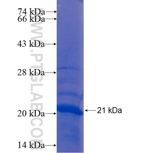 ZNF645 fusion protein Ag22392 SDS-PAGE