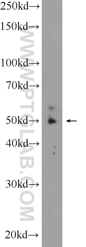 Western Blot (WB) analysis of mouse heart tissue using ZNF649 Polyclonal antibody (25797-1-AP)