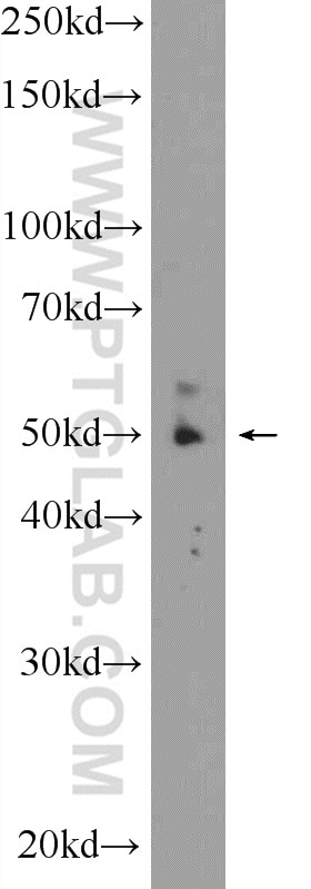 WB analysis of mouse heart using 25797-1-AP